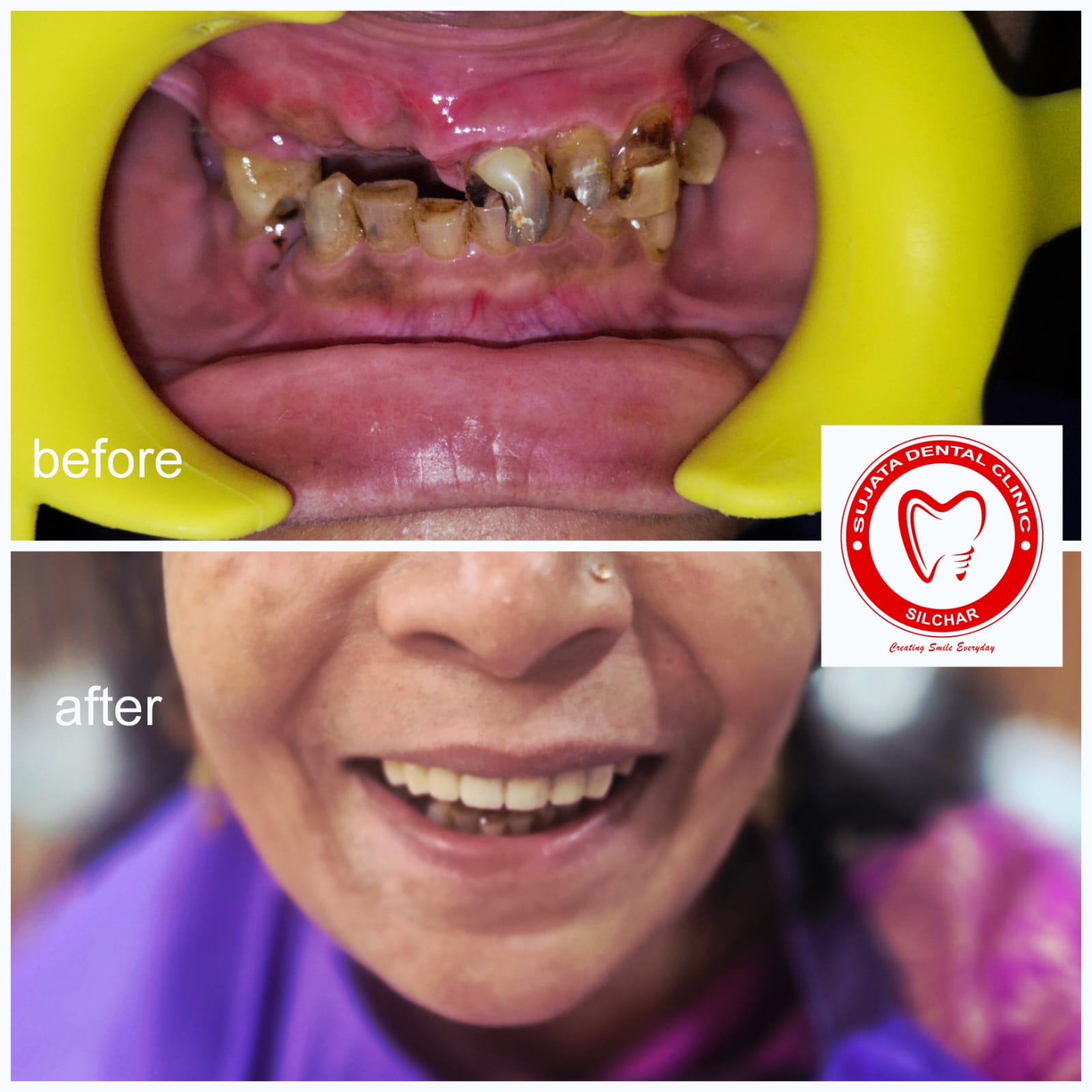 Smile transformation 8