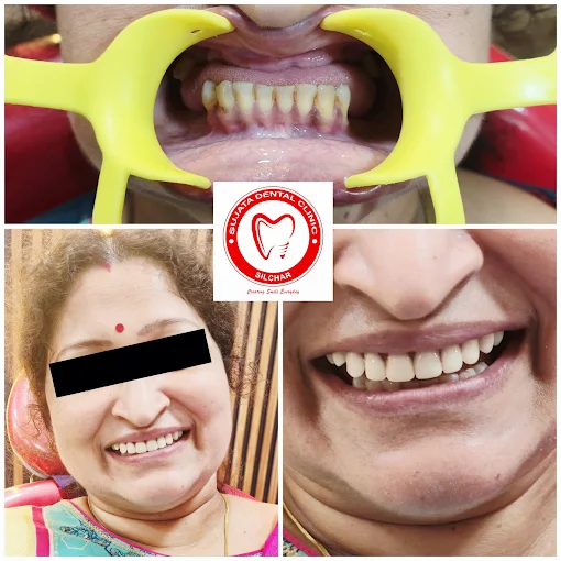 Smile transformation 2